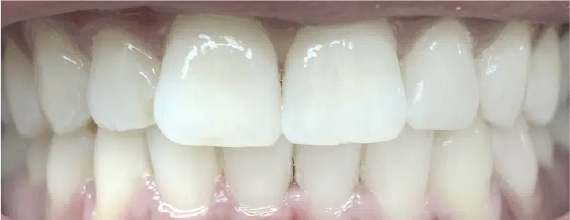 Smile Gallery. Dentist in Palm Bay, FL. Dr. Marc A. Christy, River Oak Dental