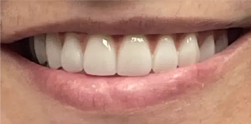 Smile Gallery. Dentist in Palm Bay, FL. Dr. Marc A. Christy, River Oak Dental