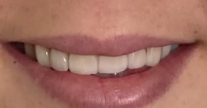Smile Gallery. Dentist in Palm Bay, FL. Dr. Marc A. Christy, River Oak Dental