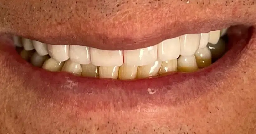 Smile Gallery. Dentist in Palm Bay, FL. Dr. Marc A. Christy, River Oak Dental