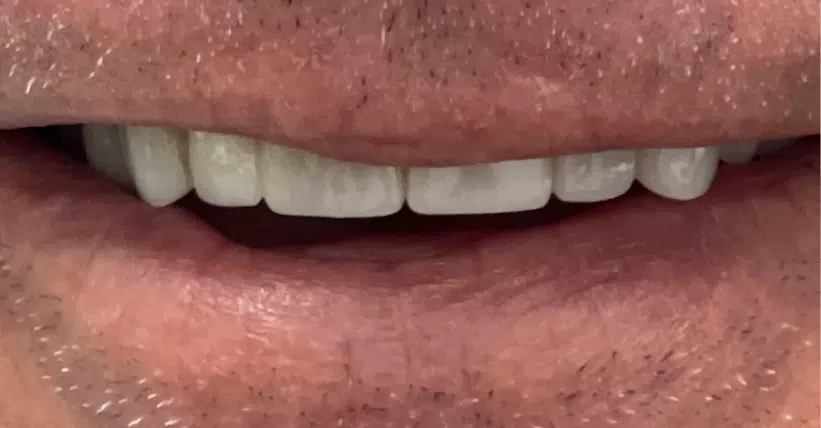 Smile Gallery. Dentist in Palm Bay, FL. Dr. Marc A. Christy, River Oak Dental