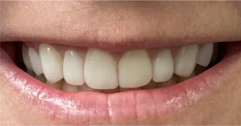 Smile Gallery. Dentist in Palm Bay, FL. Dr. Marc A. Christy, River Oak Dental