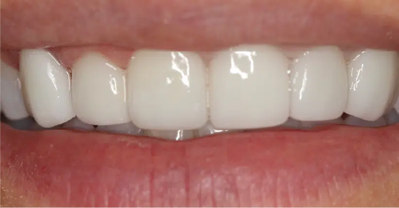 Smile Gallery. Dentist in Palm Bay, FL. Dr. Marc A. Christy, River Oak Dental