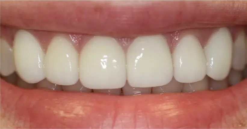 Smile Gallery. Dentist in Palm Bay, FL. Dr. Marc A. Christy, River Oak Dental
