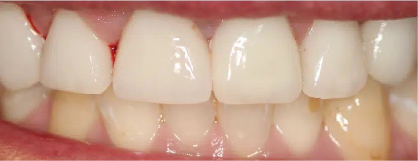 Smile Gallery. Dentist in Palm Bay, FL. Dr. Marc A. Christy, River Oak Dental