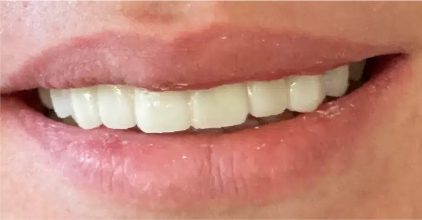 Smile Gallery. Dentist in Palm Bay, FL. Dr. Marc A. Christy, River Oak Dental