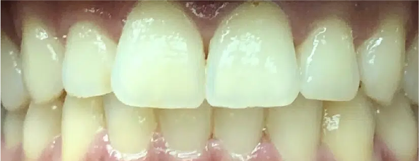Smile Gallery. Dentist in Palm Bay, FL. Dr. Marc A. Christy, River Oak Dental
