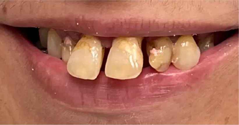 Smile Gallery. Dentist in Palm Bay, FL. Dr. Marc A. Christy, River Oak Dental