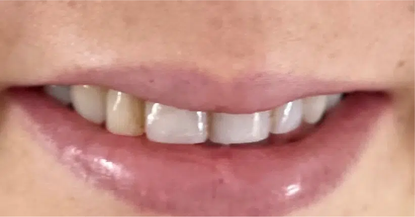 Smile Gallery. Dentist in Palm Bay, FL. Dr. Marc A. Christy, River Oak Dental