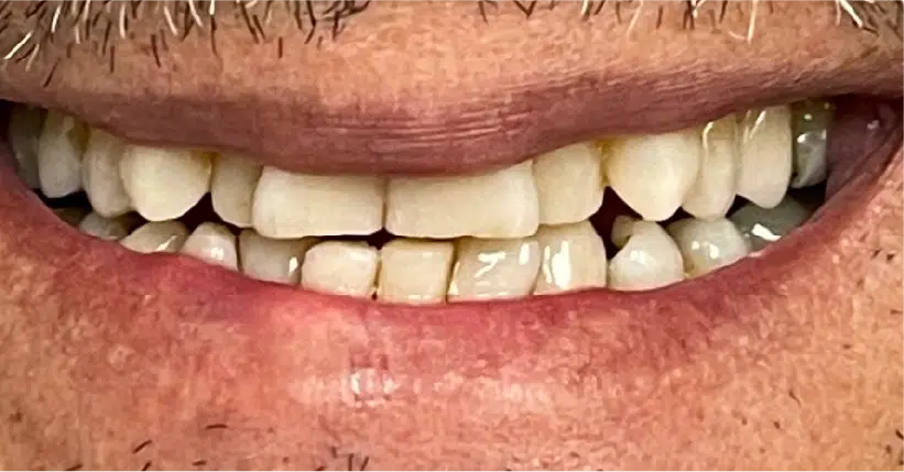 Smile Gallery. Dentist in Palm Bay, FL. Dr. Marc A. Christy, River Oak Dental