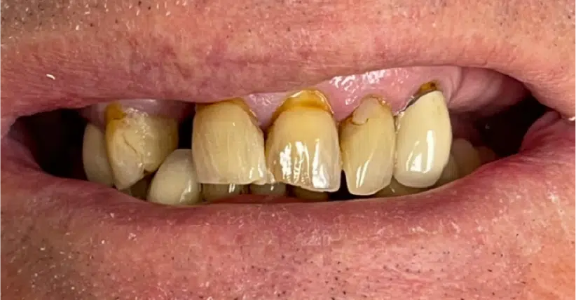 Smile Gallery. Dentist in Palm Bay, FL. Dr. Marc A. Christy, River Oak Dental