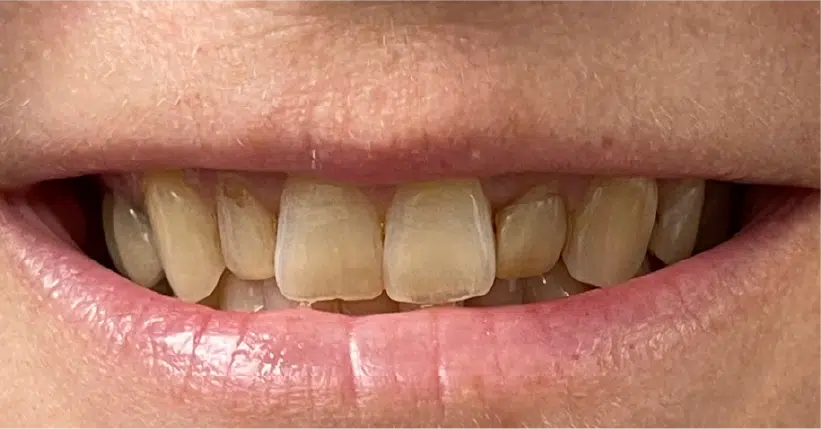 Smile Gallery. Dentist in Palm Bay, FL. Dr. Marc A. Christy, River Oak Dental