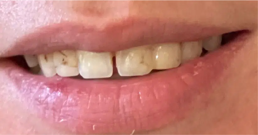 Smile Gallery. Dentist in Palm Bay, FL. Dr. Marc A. Christy, River Oak Dental