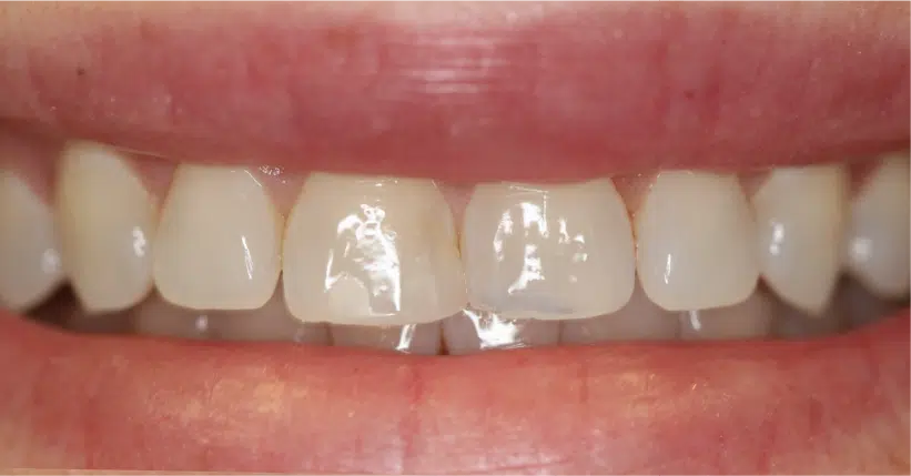 Smile Gallery. Dentist in Palm Bay, FL. Dr. Marc A. Christy, River Oak Dental