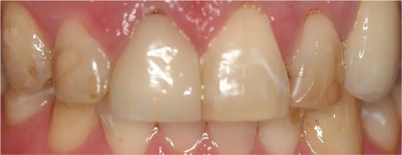 Smile Gallery. Dentist in Palm Bay, FL. Dr. Marc A. Christy, River Oak Dental