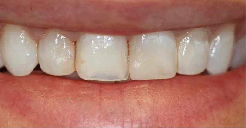 Smile Gallery. Dentist in Palm Bay, FL. Dr. Marc A. Christy, River Oak Dental